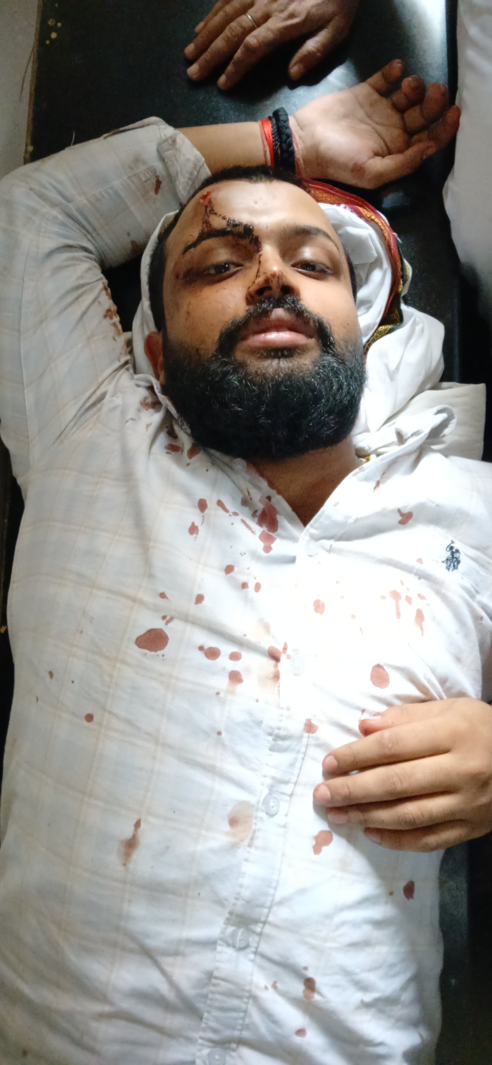 ब्रेकिंग न्यूज़।। जमीन विवाद में हिंसक झड़प के साथ गोली चली, एक युवक सिर पर गंभीर चोट और दूसरे के हाथ मे गोली छूकर निकली