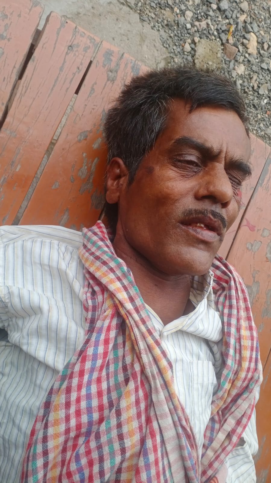 रोड क्रॉस करते समय युवक हुआ गंभीर घायल, पुलिस ने तत्परता दिखाकर ट्रॉमा सेंटर भिजवाया